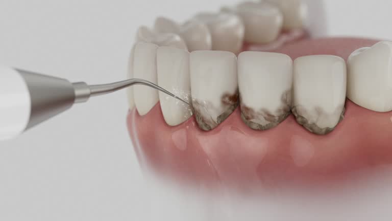 Trusted Wisdom Tooth Removal service in Cross Plains, TN - Dentist Open Now